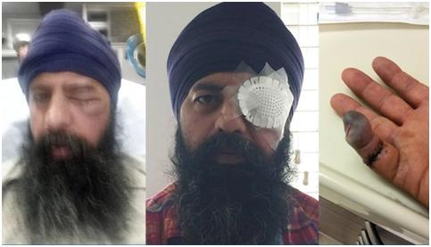 California Hate Crime Against Sikh Man Yields Prison Terms for Assailants